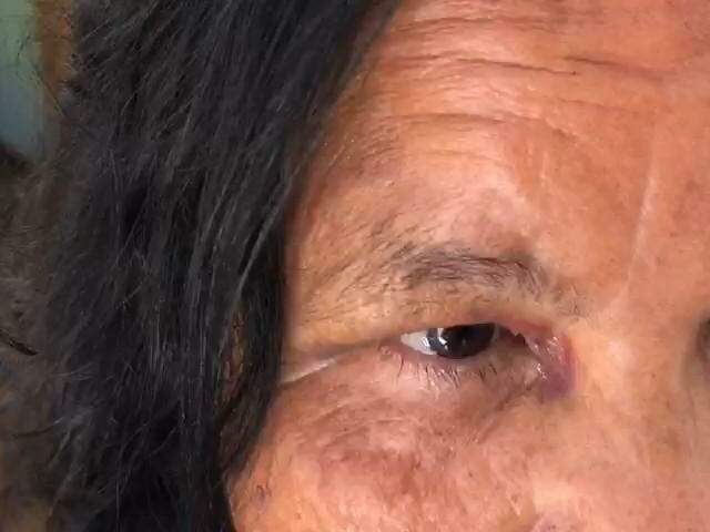 Antônia Domingos Alves Duarte, de 66 anos, ficou ferida em várias partes do corpo. (Foto: Marcos Maluf)
