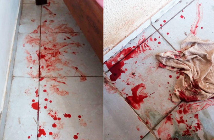 Sangue ficou espalhado por onde o cachorro passou (Foto: arquivo pessoal)