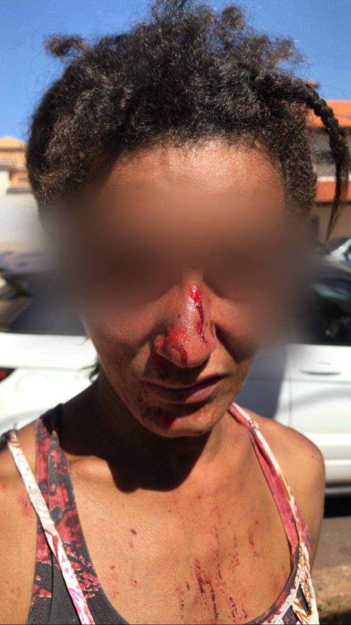 Vítima sofreu lesões no nariz e foi socorrida pelo Corpo de Bombeiros (Foto: Thailla Torres)