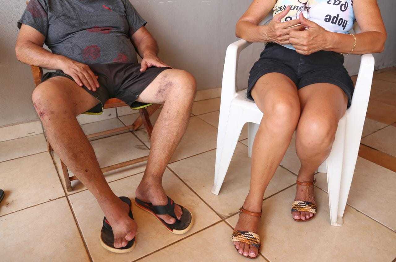 Com medo de represálias e da volta do agressor, casal vítima pensa até em se mudar. (Foto: Paulo Francis)